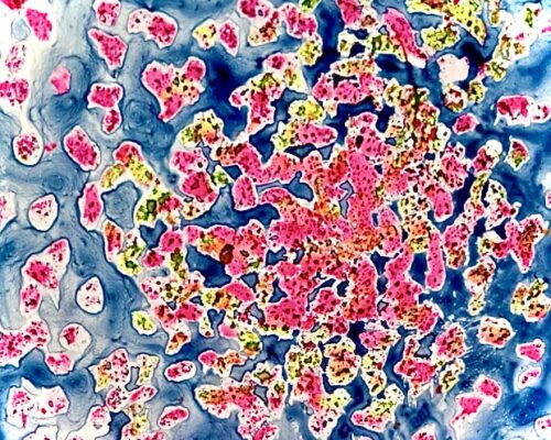 Abstraktes, mikroskopisch anmutendes Bild mit vielen unregelmäßigen, rosa und gelb gefleckten Formen auf blauem, wolkigem Hintergrund. Die farbigen Inseln verdi